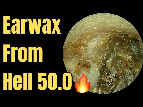 Earwax From Hell 50.0🔥
