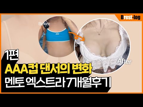 AAA컵에서 자연스러운 B컵 I 댄서 가슴수술 6개월 후기 I 리얼 인터뷰 1편 | 윈느성형외과 라벨윈느 유튜브 영상