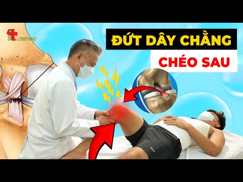 Phải Làm Gì Khi Đứt Dây Chằng Chéo Sau Khiến Bạn Mất Khả Năng Vận Động?