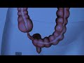 The Anatomy of the Appendix