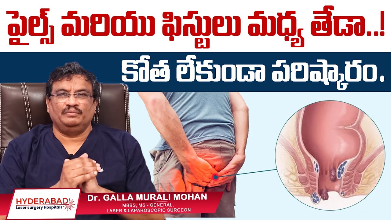 Fissure Laser Treatment Video 4