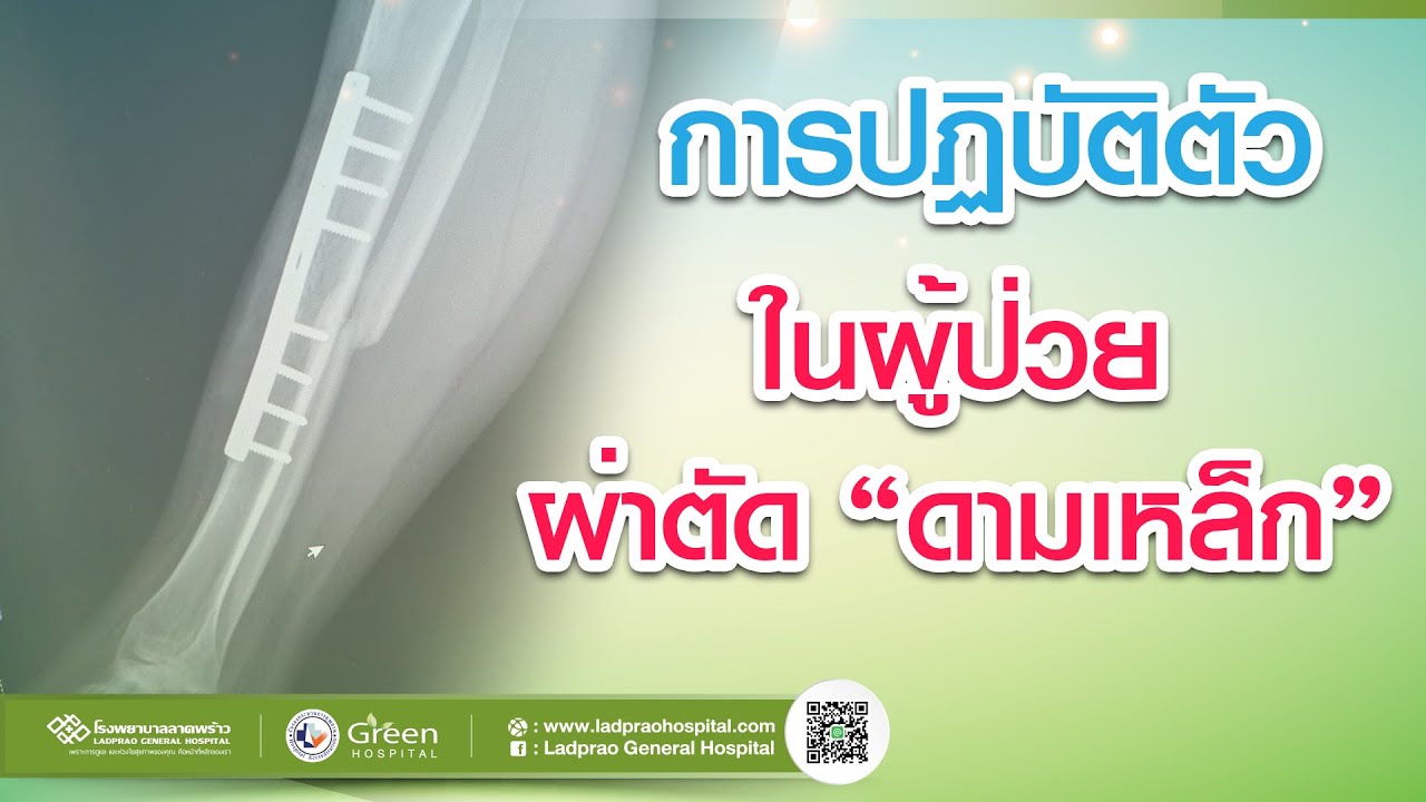 การปฏิบัติตัว ในผู้ป่วย "ผ่าตัดดามเหล็ก"