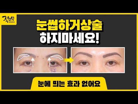 눈썹하거상술 하지마세요.