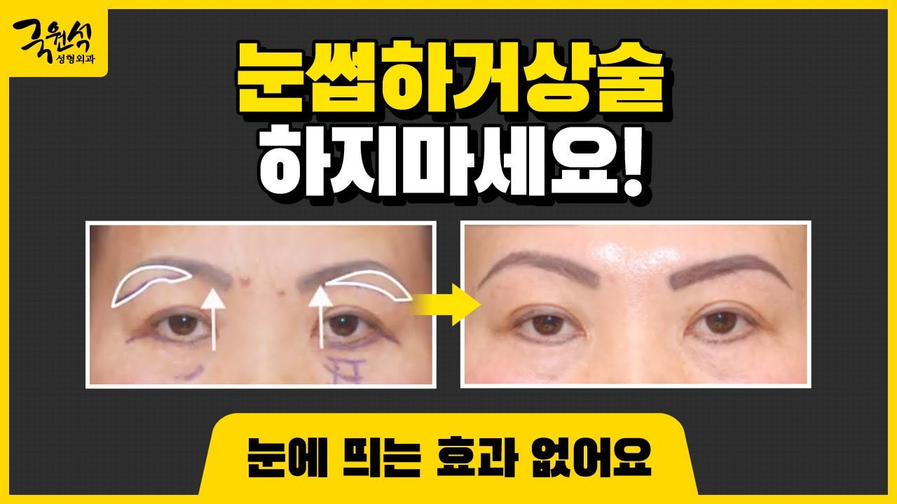 눈썹하거상술 하지마세요.