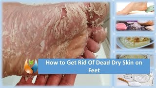 How to Get Rid of Dead Dry Skin on Feet