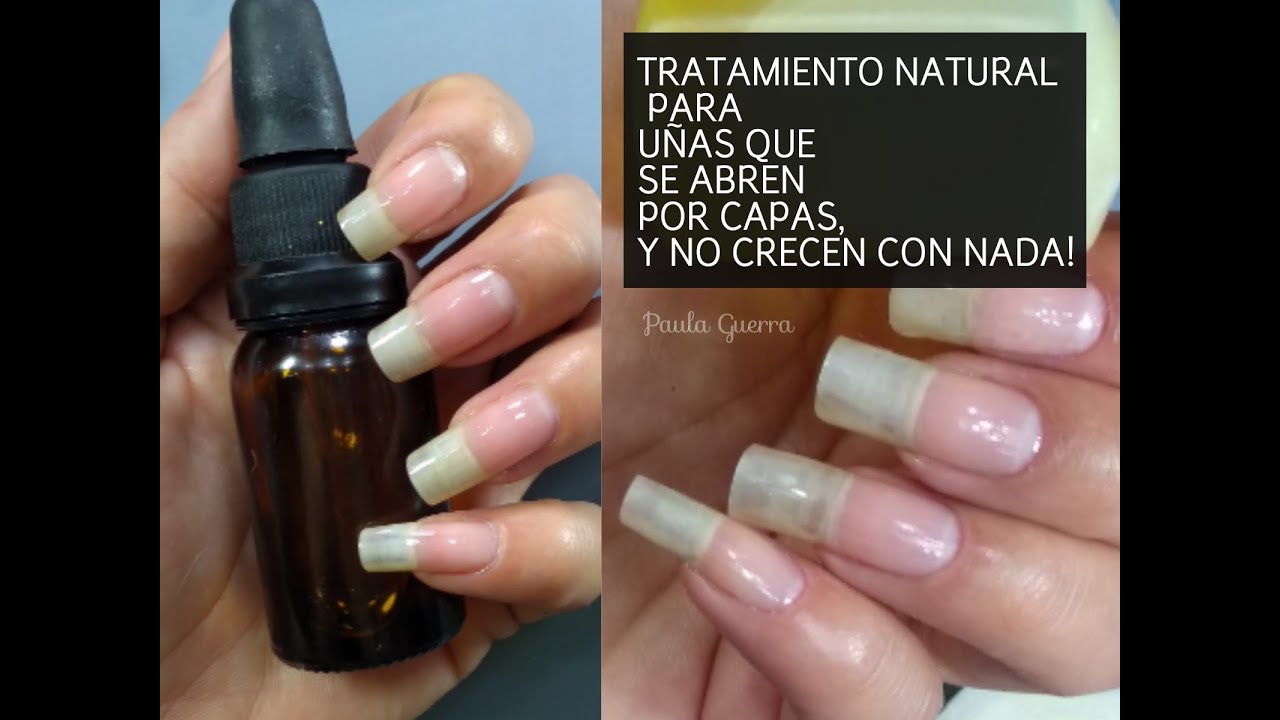 Watch TRATAMIENTO NATURAL PARA UÑAS QUE SE ABREN POR CAPAS |Y NO CRECEN CON NADA| Now TRATAMIENTO NATURAL PARA UÑAS QUE SE ABREN POR CAPAS |Y NO CRECEN CON NADA|