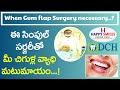 When Gum Surgery Needed || Flap Surgery || Treatment For Gum Disease || Dr Chandra Shekar Alladi