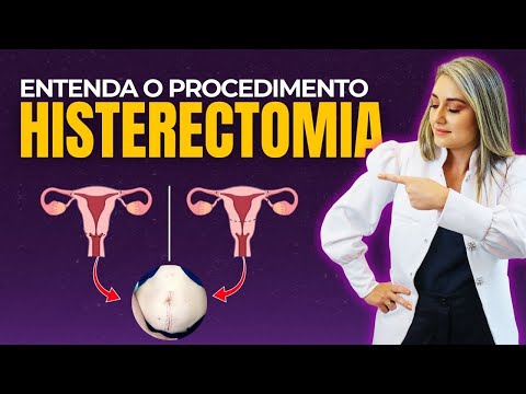 HOW HYSTERECTOMY IS PERFORMED