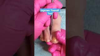 Download lagu Ingrown Toenail Tool #ingrowntoenail #nailclass #naileducation #nailtechlife #pedicuretutorial mp3