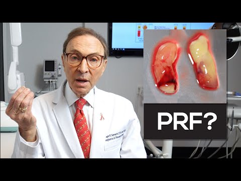 How We Use Your Own Blood To Make PRF | Platelet Rich Fibrin