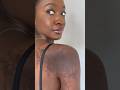 Tattoo, Scar, Bruise Need A Cover Up?