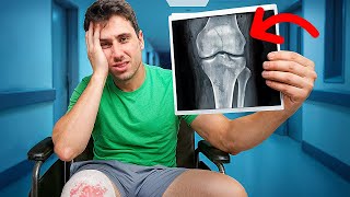 I Broke My Kneecap...