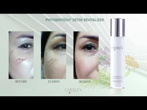 CHOLLEY Phytobiotech Detox Revitalizer