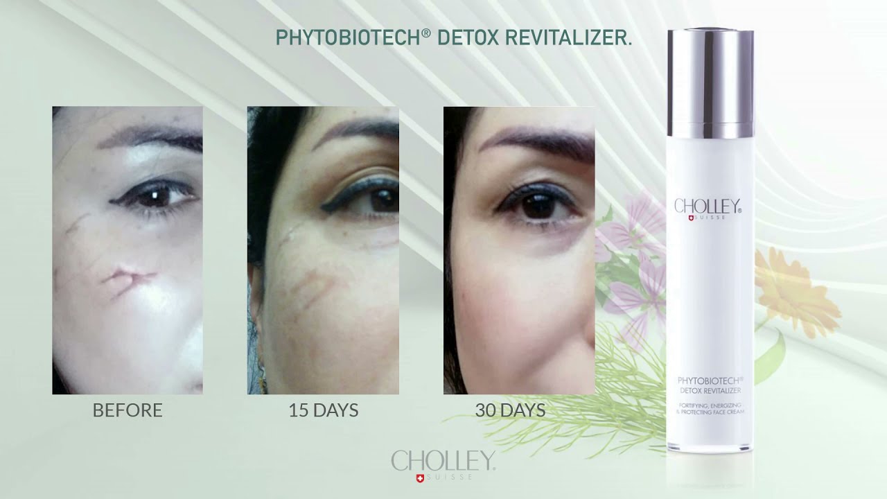 CHOLLEY Phytobiotech Detox Revitalizer
