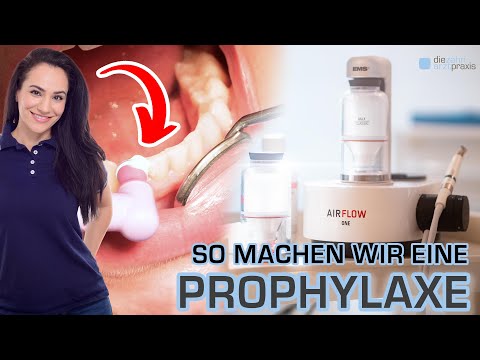 was während einer Prophylaxe (PZR) GENAU passiert!