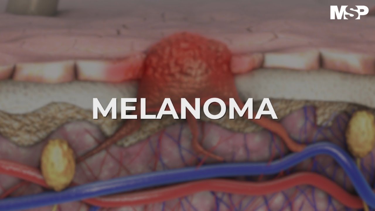 Miguel Angel Flores Terry-9