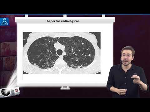 Doença Pulmonar Obstrutiva Crônica (DPOC) - Aula de Pneumologia SanarFlix