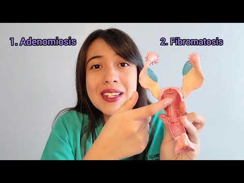 ¿Por qué no puedo embarazarme?