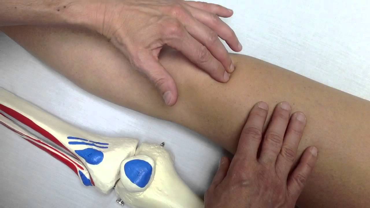 4  Cul de sac sous quadricipital