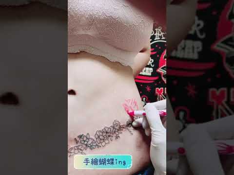 刺青蓋疤禁忌