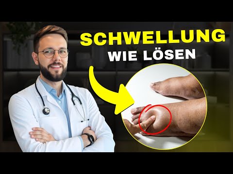 Swollen feet? 6 home remedies that really work