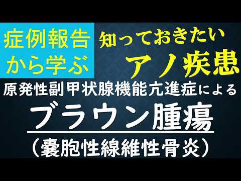 副甲状腺腺腫