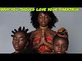 REASONS YOU SHOULD LOVE YOUR DARK MELANATED SKIN