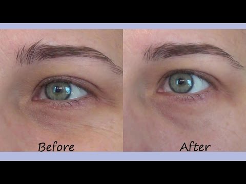 kiehl's midnight recovery before and after