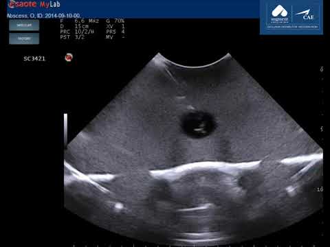 CAE Blue Phantom Sciatic Nerve Regional Anaesthesia Ultrasound Training Model