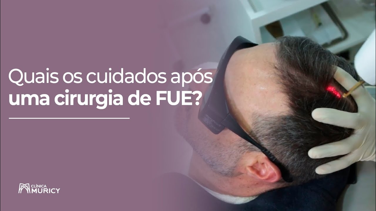 Pós operatório do FUE