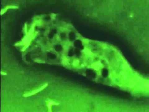 THE WORLD OF MICROBES -- In Quest of the Tubercle Bacilli -Produced by Tokyo Cinema Co., Inc.」