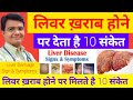 लिवर ख़राब होने से पहले देता है ये 10 संकेत | Liver Khar