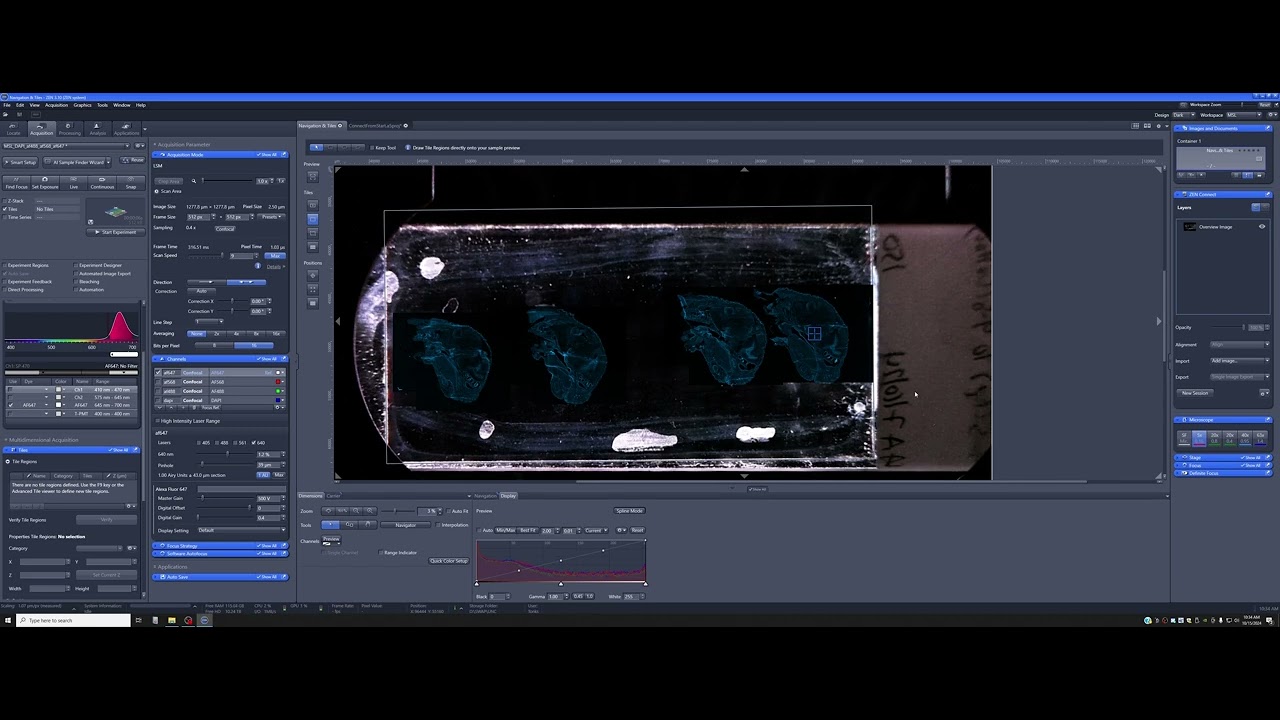 15 Using Zen Connect (OPTIONAL)