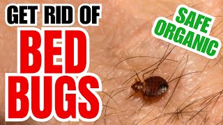 How To Get Rid Of Bed Bugs | 10 Safe Organic And Natural Methods