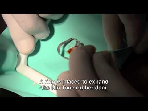 ANTIVET, Solution for cleaning dental enamel