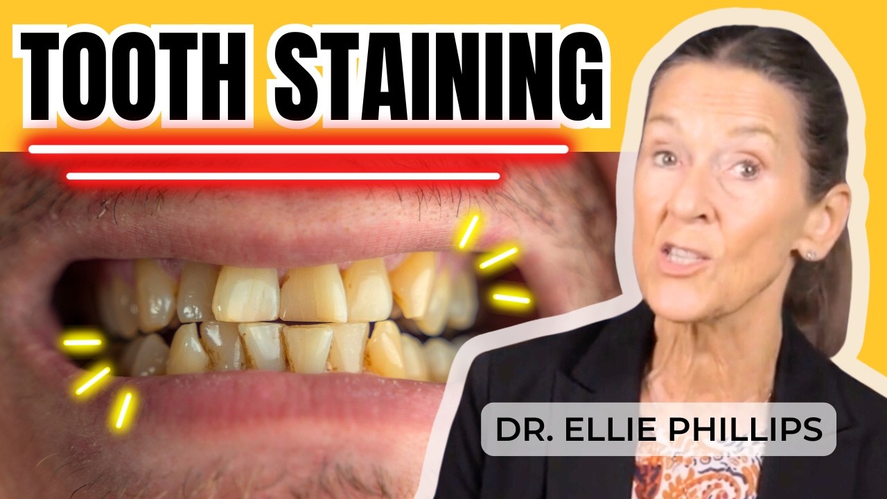 Why You Have Tooth Staining