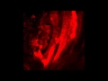Real-time imaging of flow through the placental vasculature.