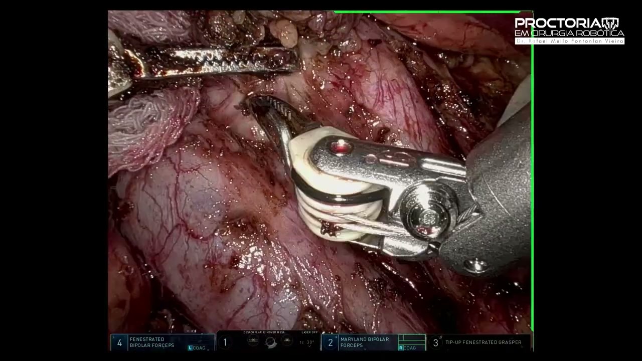 Rafael Mello Fontolan Vieira-5