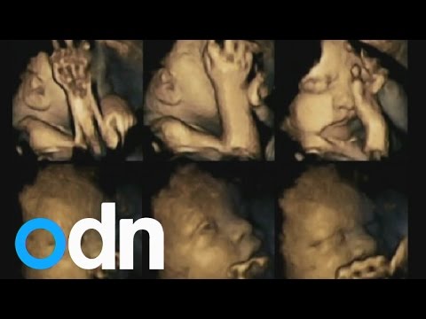 Šta se dešava bebi u stomaku kad mama zapali cigaretu | Yumama