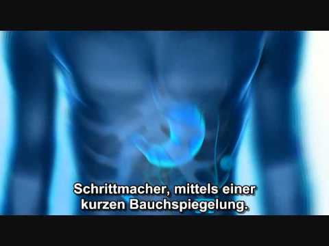 Hypertensive Krise GTA San Andreas Klinische Pharmakologie und Hypertonie