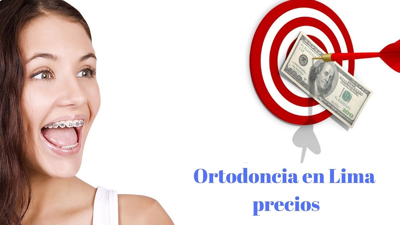 ortodoncia lima precios - Dr- Hermes Huertas- estética dental y ortodoncia en lima perú
