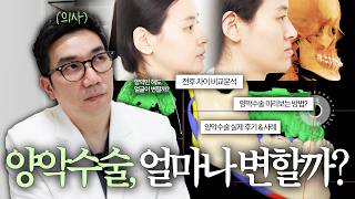 양악수술 얼마나 변할까? 실제 BEFORE & AFTER 비교분석  |  안될 턱이 있나 썸네일 이미지