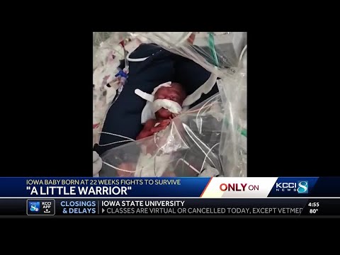 Waukee 'micro-preemie' born at just 22 weeks in NICU at Iowa hospital