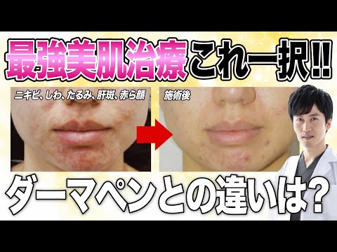 ポマカンサス・パルについて詳しく解説