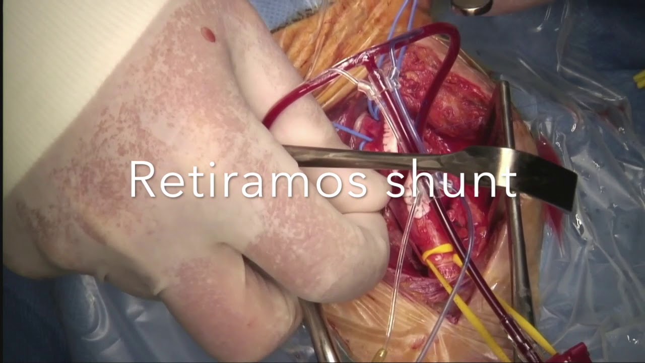 Paulina Pérez Ramírez-30