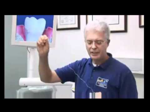 Eau Claire Dental Tip How to Stop Gum Disease