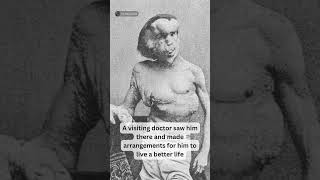 The Elephant Man 🐘