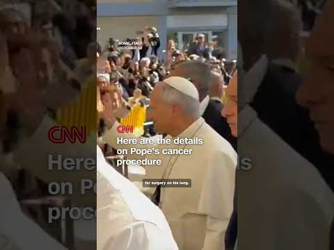 Here are the details on Pope’s cancer procedur