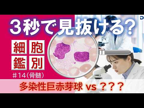 【3秒で見抜ける？】多染性巨赤芽球の見分け方｜血液形態クイズ #14