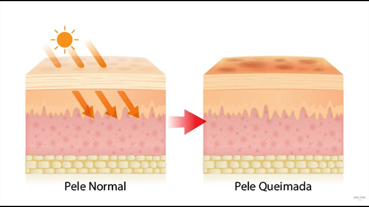 VOCÊ SABE A DIFERENÇA ENTRE A RADIAÇÃO UVA E UVB NA PELE - AULA 01 | SKINSCIENCE
